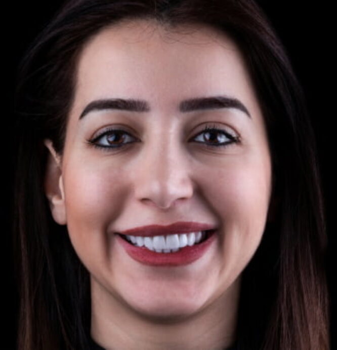 Composite Gallery Image