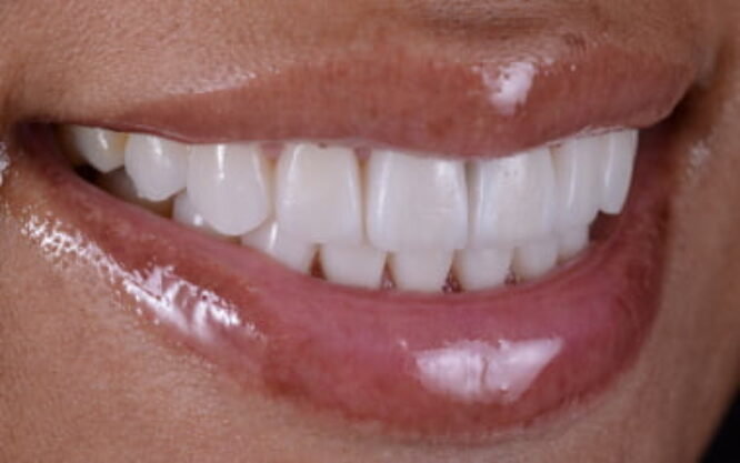 Composite Gallery Image