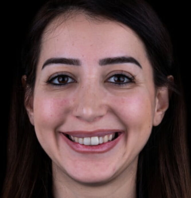 Composite Gallery Image