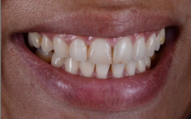 Composite Gallery Image