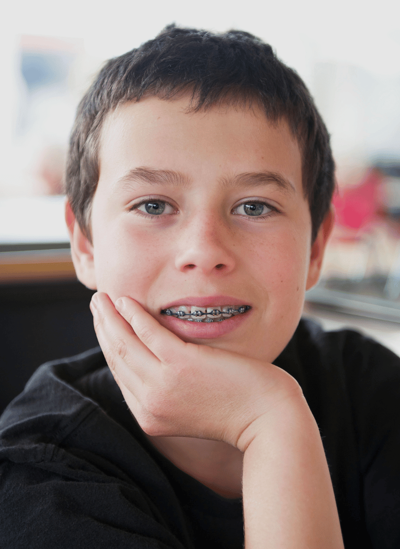 Childrens Braces